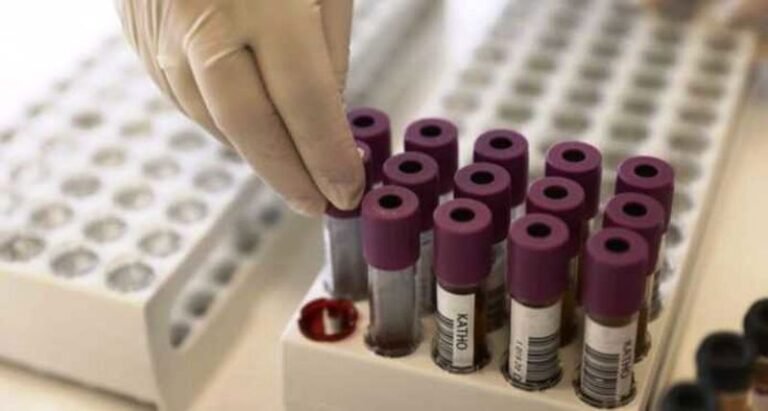 Αύξηση της τάξης του 30% στις τιμές των εξετάσεων